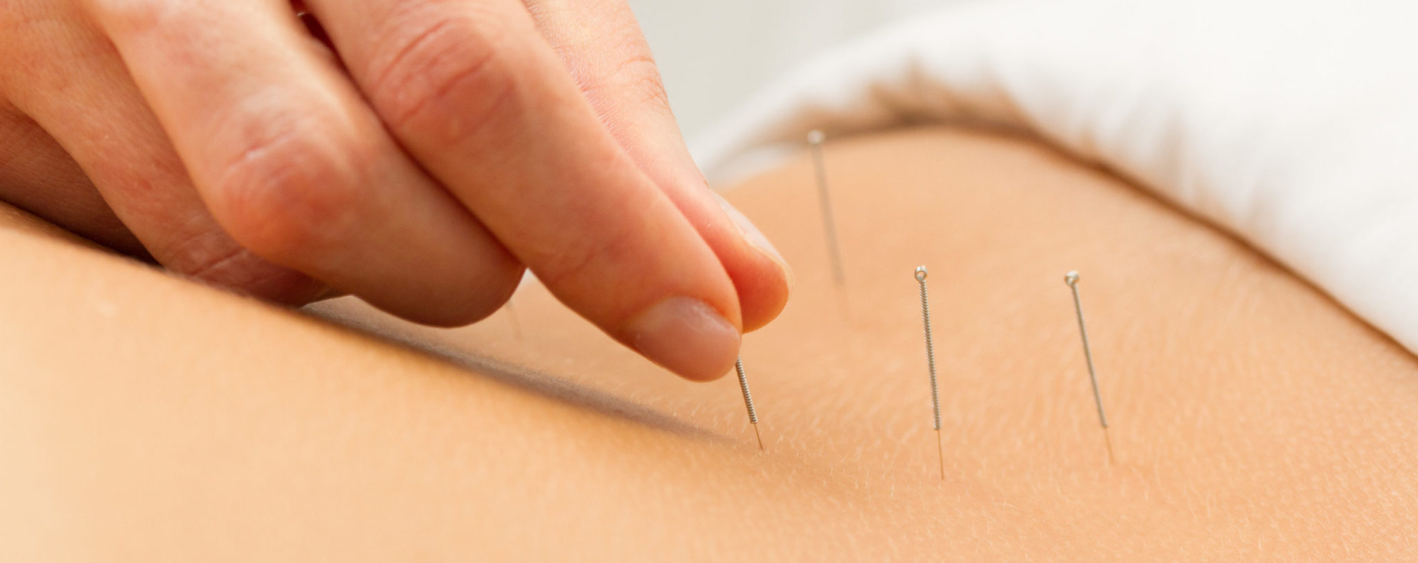 Benessere Miami Acupuncture, Massage Therapy, Hydrafacial, Iridology